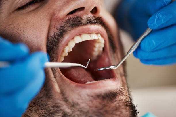 Best Emergency Broken Tooth Repair in Rk Forest Village, PA